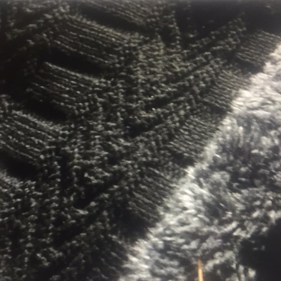 Restocked 5⭐️2 pieces Set - Picture 3 of 5